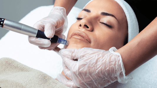 Microneedling-behandling i ansiktet där en hudterapeut använder en microneedling-pen på kinden för att stimulera kollagenproduktion, förbättra hudstruktur och ge jämnare hudton.